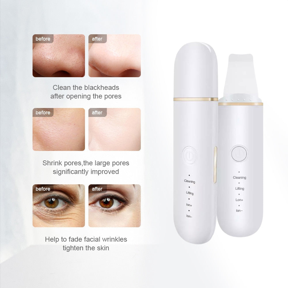 Ultrasonic Skin Scrubber